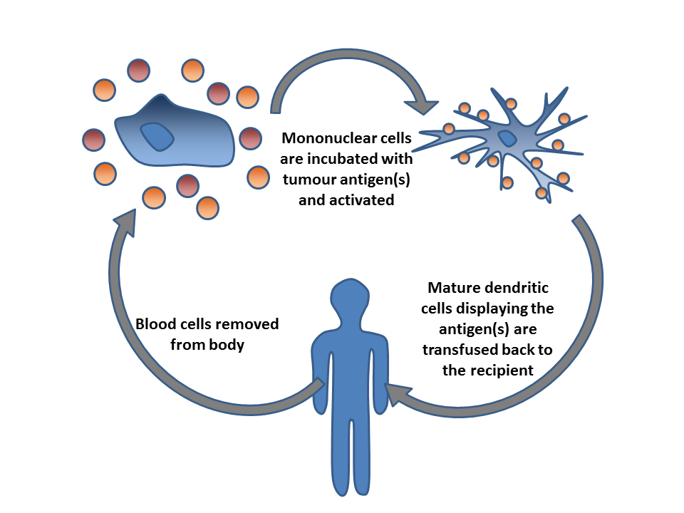 Diagram showing how dendritic cell vaccination collects immune cells, loads them with tumor antigens, and returns them to stimulate T cells against cancer cells